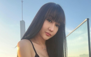 Lucinta Luna Bedah Wujud Lagi Demi Mirip Idol K-Pop, Hidung Baru Seharga Mobil Pajero