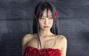 Luka di Wajah Jennie BLACKPINK Belum Sembuh, Jadi Perhatian Saat Balik dari Malaysia