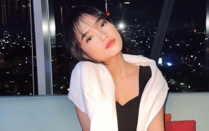 Fuji An Pamer Wajah Breakout Saat Sakit, Mata Sembab Ikut Jadi Sorotan