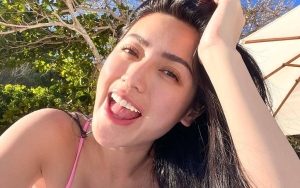 Habis Oplas Hidung, Jessica Iskandar Curhat Harus Napas Melalui Mulut Saat Tidur