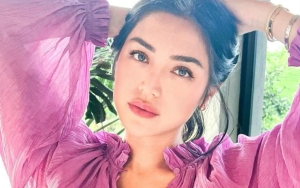 Hasil Natural, Jessica Iskandar Dipuji Makin Cantik Sempurna Usai Operasi Hidung