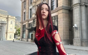 Jisoo BLACKPINK Buka-bukaan Soal Prosedur Perawatan di Balik Gigi Cantiknya
