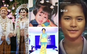 Bella Bonita Istri Denny Caknan Dituding Oplas, Intip 7 Potretnya Dulu Vs Kini 