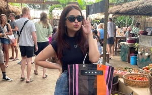 Rebecca Klopper Healing Usai Kasus Video Syur Berdampak ke Mental dan Bikin Kehilangan Job