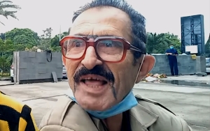 Pelawak Eko Londo Terbaring Koma Usai Alami Kecelakaan Tunggal