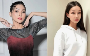 Wajah Sarwendah di Hari ke-10 pasca Oplas Disebut Mirip Lucinta Luna