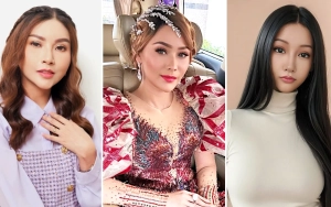 Sarwendah Pakai Lemak Paha untuk Oplas usai Wajah Disebut Mirip Inul dan Lucinta Luna