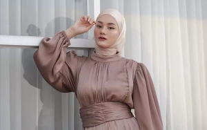 Dinda Hauw Alami Kecelakaan saat Berkuda Hingga Dilarikan ke IGD