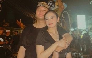 Rizky Febian Ikut Dikira Oplas kala Wajah Mahalini Disebut Mirip Indah Permatasari Imbas Isu Permak