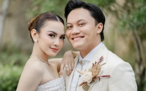 Foto Mahalini Semasa Kecil Disorot Lagi usai Wajahnya dan Rizky Febian Dicurigai Hasil Oplas