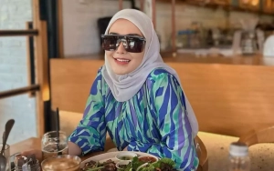 Wajah Marissya Icha Gosong usai Lakukan Perawatan
