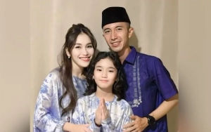 Ayu Ting Ting Adu Cantik Bareng Bilqis usai Foto Tampan Eks Tunangan Bahas Luka Disorot