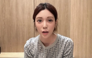 Wajah Lizzy Mantan Bintang 'Running Man' Sulit Dikenali usai Terlibat DUI