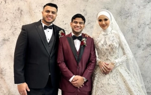 Wajah Cantik Kakak Ipar Fadil Jaidi No Edit-Edit Sukses Bikin Pangling saat Pemotretan