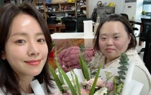 Jung Eun Hye Aktris Down Syndrome dari 'Our Blues' Umumkan Menikah