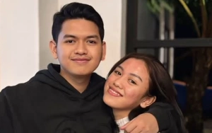 Wajah dan Gigi Laura Putri Nikita Mirzani Dipuji Makin Kinclong saat Video Call dr Oky