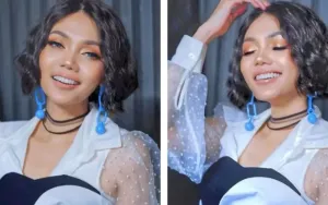 Rina Nose Pilih Tompi untuk Operasi Hidung, Ini Alasannya!