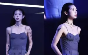Model Choi Jun Hee Akui Jalani Prosedur Estetika Menjelang Pernikahan