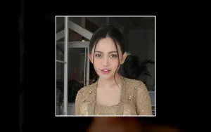 Rachel Vennya Dituduh Dianiaya, Foto Mata Lebam Beredar di Media Sosial