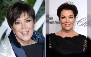Kris Jenner Kesal Hasil Facelift Rp1,7 M Memudar, Ingin Revisi Segera