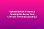 Kekhawatiran Menyusul Penampilan Buruk Yoni Chirinos di Pembukaan Liga