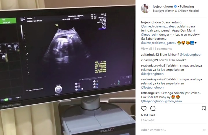 Lee Jeong Hoon dan Moa Aeim Dikaruniai Anak Perempuan