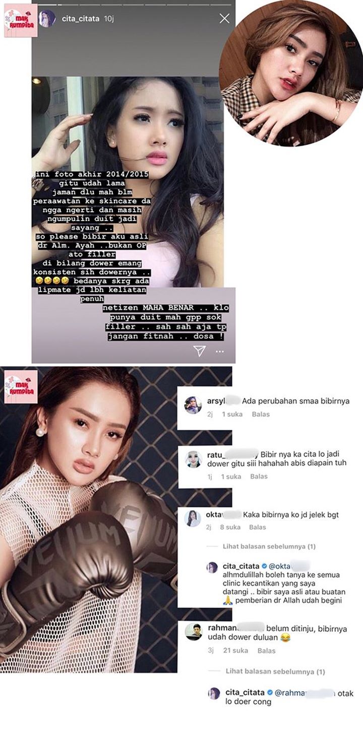 Cita Citata Dicibir Bibirnya Aneh