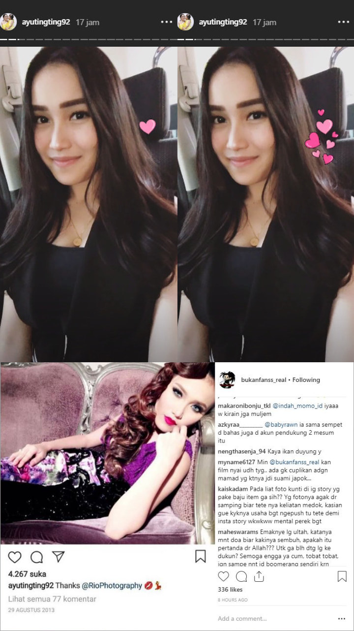 Ayu Ting Ting