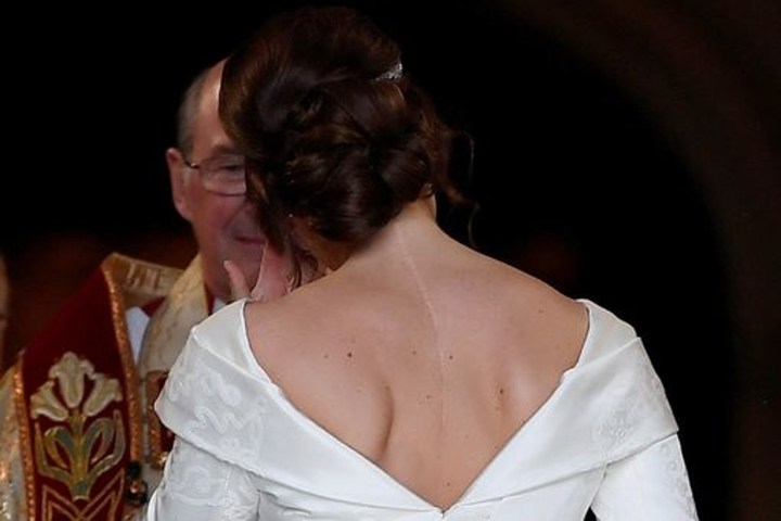 Gaun Indah Putri Eugenie Perlihatkan Bekas Luka di Tubuhnya