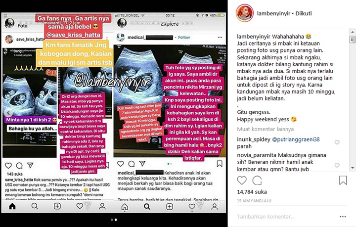 Foto USG Nikita Mirzani Comot Akun Lain