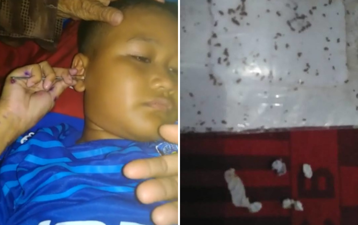 Viral Seorang Bocah Asal Majalengka Keluarkan Ratusan Semut dan Kertas Dari Telinga