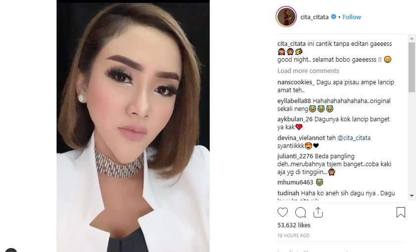 Cita Citata Pamer Foto Dagu Lancip