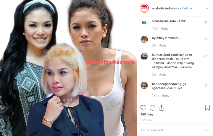 Beredar Foto Lawas Nikita Mirzani Sebelum \'Dower\' Dan Oplas Hidung Tetap Dipuji Manis