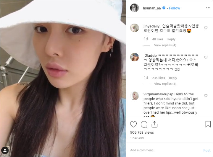 HyunA Ngotot Bibir Tebalnya Bukan Hasil Suntik Filler