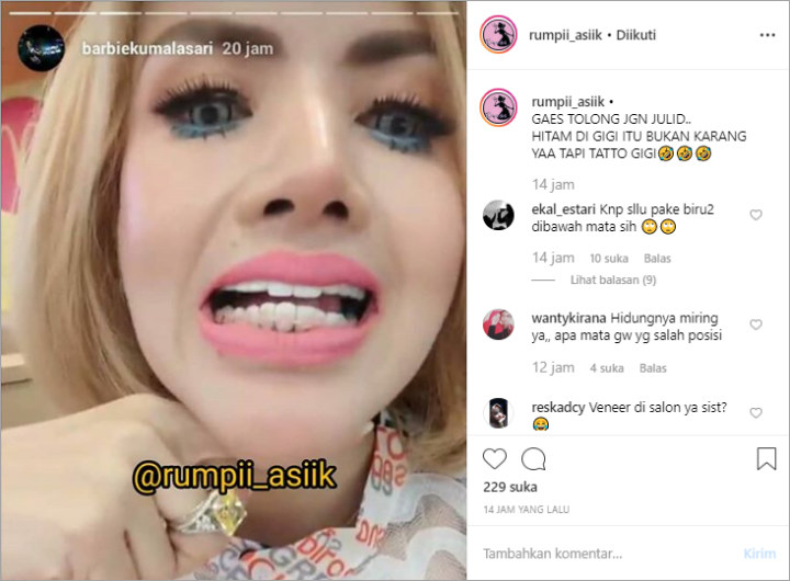 Barbie Kumalasari Nyengir Pamer Gigi