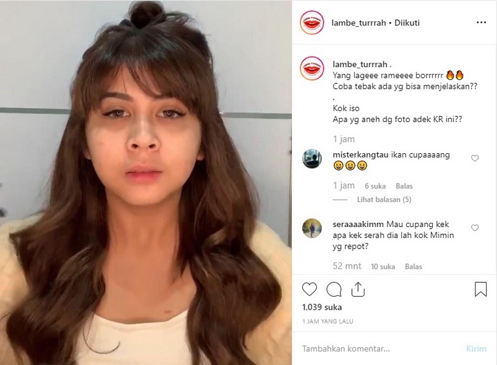 Kesha Ratuliu Bikin Heboh Gara-Gara Titik Merah di Dada, Bekas Apa?