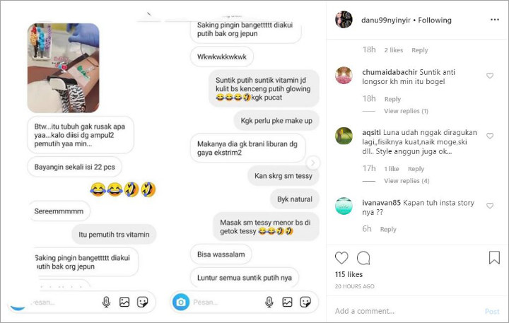 Syahrini Dicurigai Cuma Suntik Putih