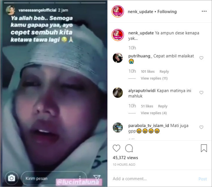 Vanessa Angel Khawatir Kepala Lucinta Luna Diperban Usai Alami Kecelakaan