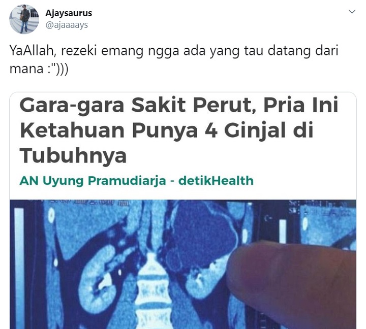 Heboh Seorang Pria Punya 4 Ginjal, Komentar \'Jahat\' Ini Justru Bikin Ngakak