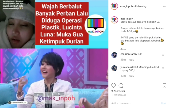 Lucinta Luna Operasi Kelopak Mata Usai Ketimpuk Durian, Sebut Kepala Diperban Ulah Dokter Usil