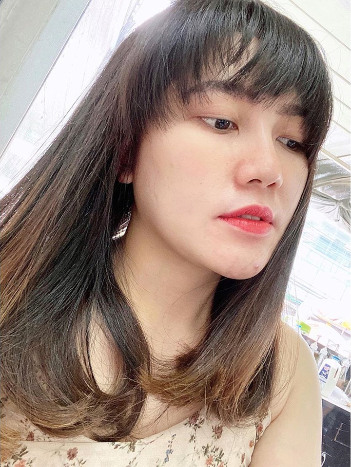 Via Vallen Sebelum Lakukan Perawatan, Sudah Cantik Ya