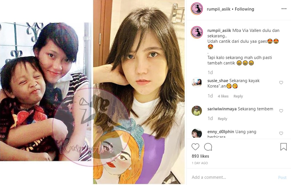 Perbandingan Potret Wajah Via Vallen Di Masa Remaja dan Sekarang Bikin Pangling