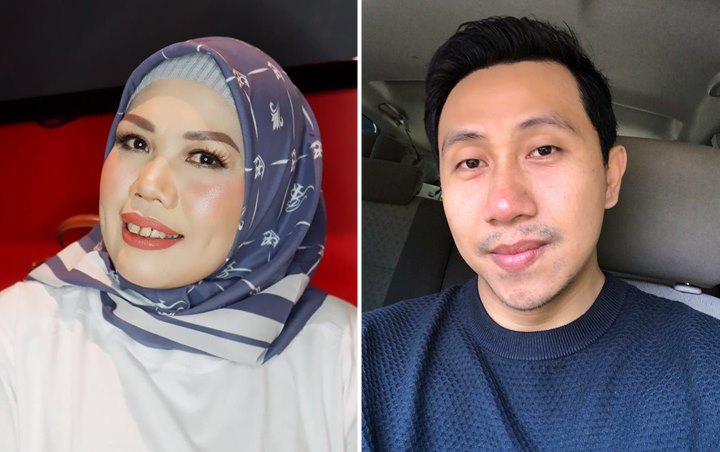 Ely Sugigi Operasi Gigi, Tanggapan Raden Rauf Ini Picu Komentar Kocak