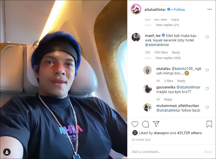 Atta Halilintar Pamer Wajah Glowing, Malah Bikin Ngakak Saat Disebut Temannya Mirip Ini