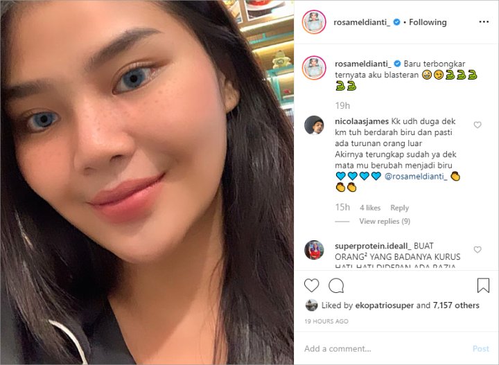 Rosa Meldianti Ubah Warna Iris Mata Hingga Ngaku Jadi Blasteran Ramai Diledek