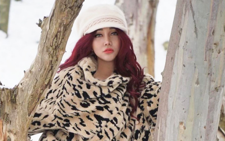 Lucinta Luna Filler Bibir Jontor Bak Disengat Tawon, Intip Kocaknya Reaksi Netizen