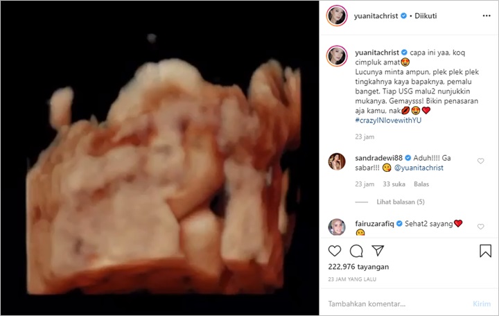 Yuanita Christiani Pamer USG Sang Calon Buah Hati