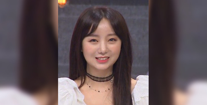 Bentuk Hidung Kei Lovelyz Disebut Memprihatinkan, Gagal Oplas?