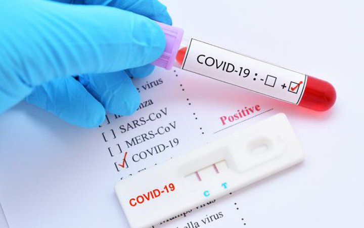 Makin Masif, 34 Karyawan Sampoerna Positif COVID-19 Usai Jalani Tes PCR