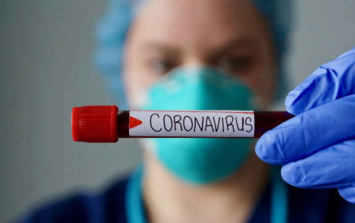 Bukan 2 Minggu, Ternyata Virus Corona Tak Lagi Bisa Ditularkan Setelah 11 Hari Infeksi